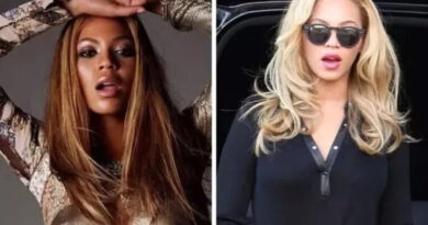 Strange Photos: Can Someone Please Explain How Beyonce Turned Herself Into Modern-Day Michael Jackson?